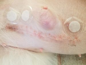 LifeWave patches on Sasha's surgery site